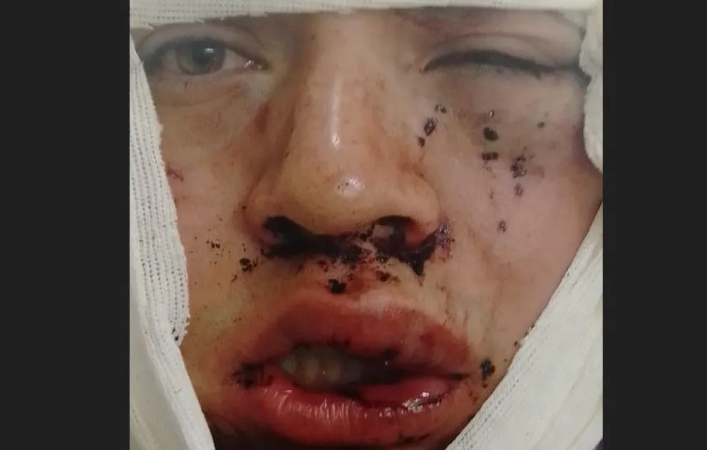 Secuestran las cámaras de seguridad del bar donde patovicas agredieron a un cliente