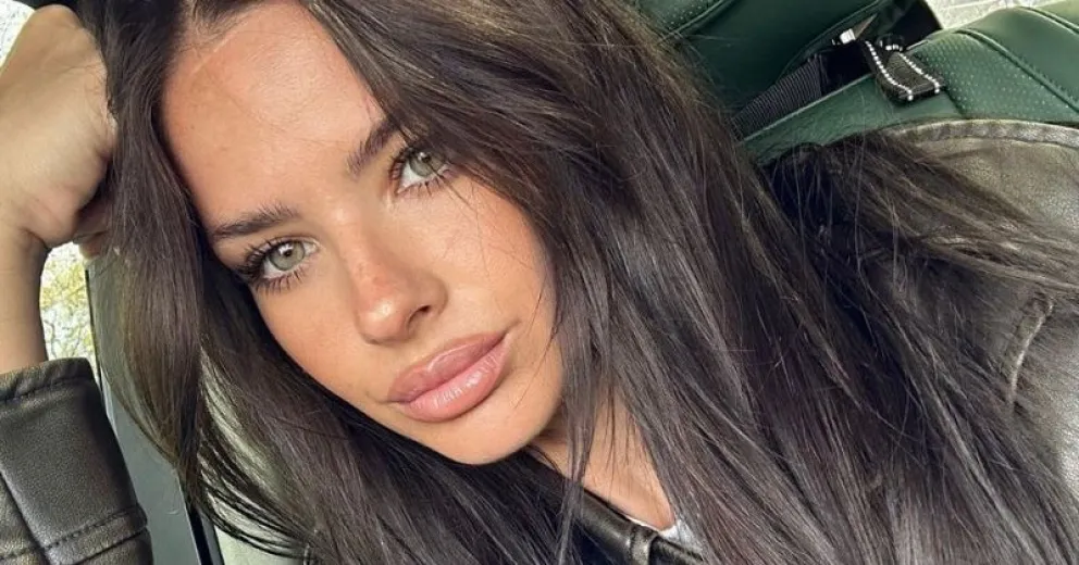 La dolorosa foto de la China Suárez ensangrentada tras un accidente doméstico