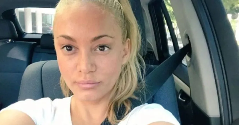 ¿Qué se hizo? El nuevo rostro de María Eugenia Ritó tras un impactante tratamiento estético