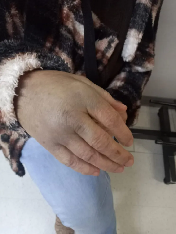 Una mujer se fracturó en una residencia de personas mayores y estuvo más de 24 horas sin asistencia