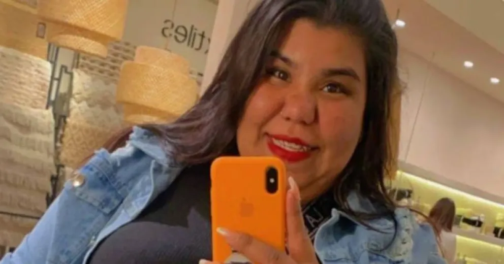 Las fotos: así quedó Camila, la hermano de Thiago de GH, tras hacerse un retoque estético