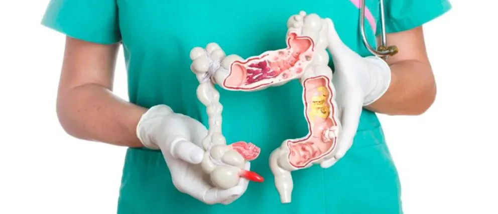 Cáncer colorrectal: La importancia de su diagnóstico y detección precoz