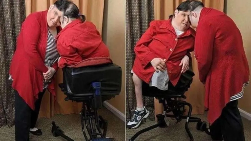 Murieron los gemelos siameses Schappel, los más longevos del mundo