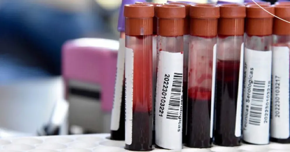 Cada vez menos gente se aplica la vacuna para evitar la hepatitis
