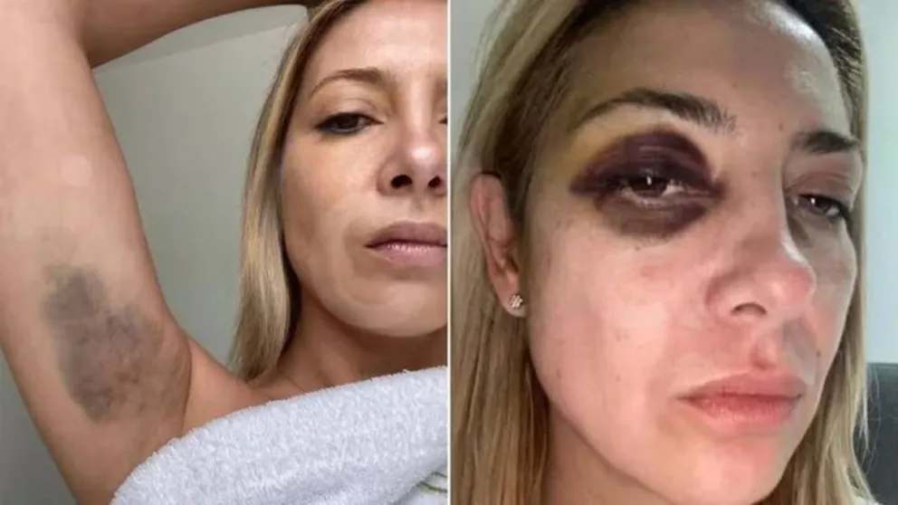 Las fotos y chats que presentó Fabiola Yáñez sobre el abuso que recibía por parte de Alberto Fernández