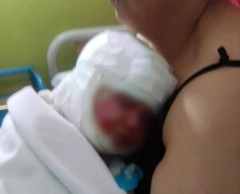 Lanzan campaña solidaria para ayudar a un bebé que sufrió graves quemaduras