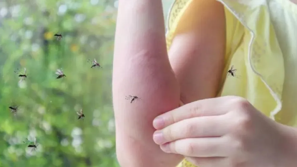 Las razones por las que los mosquitos pican más a ciertas personas