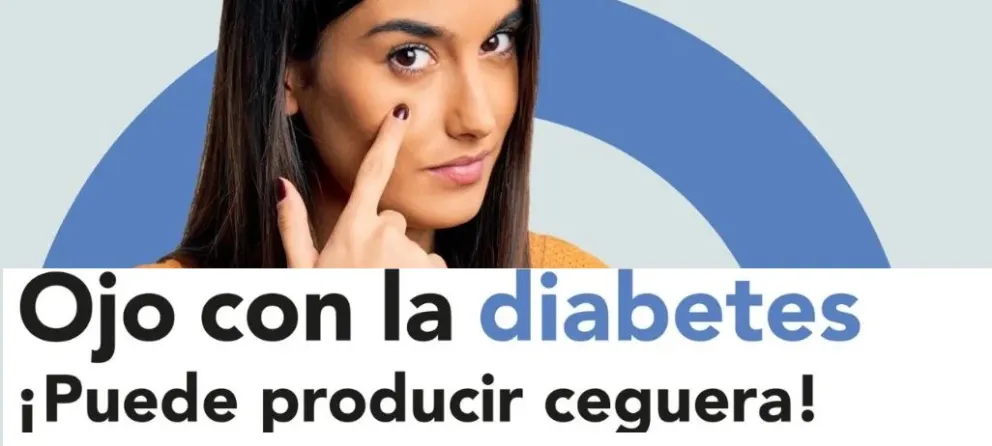Importante tener en cuenta para realizar consultas.
