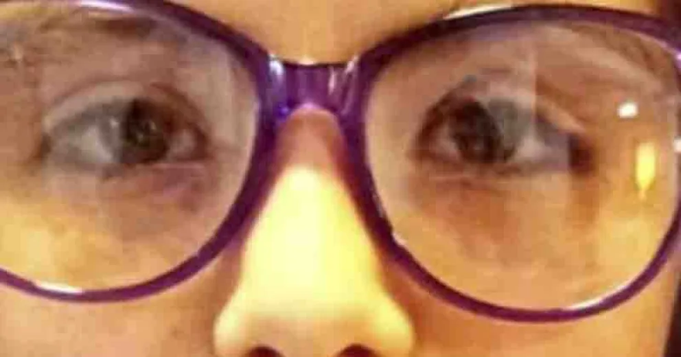 Sólo podrán concurrir quienes deban retirar sus anteojos.