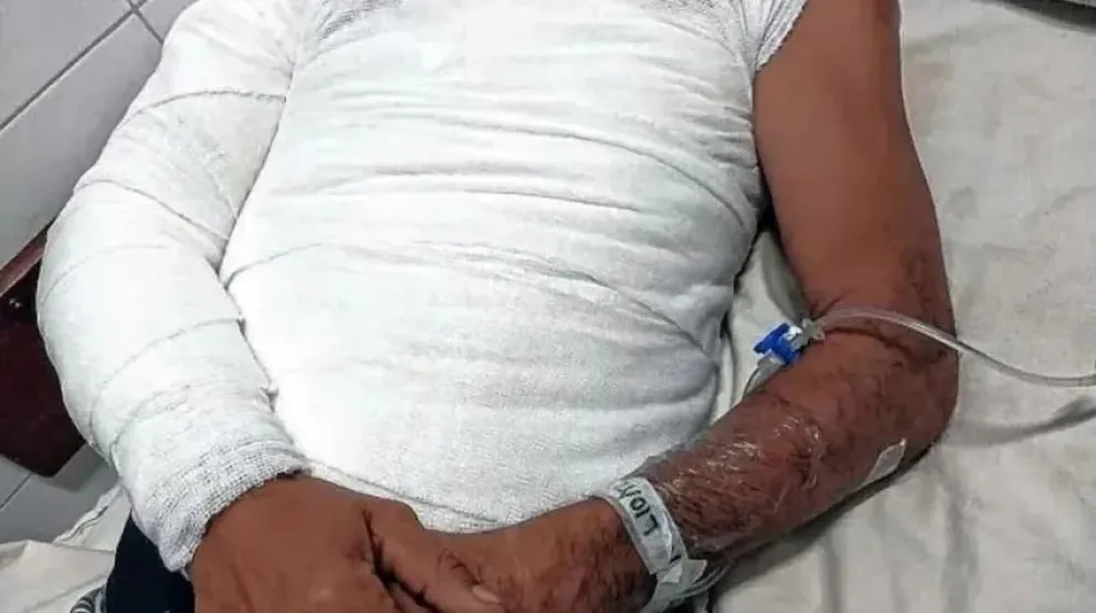 La víctima decidió no presentar cargos contra su hermano y solicitó asistencia psicológica para él.
