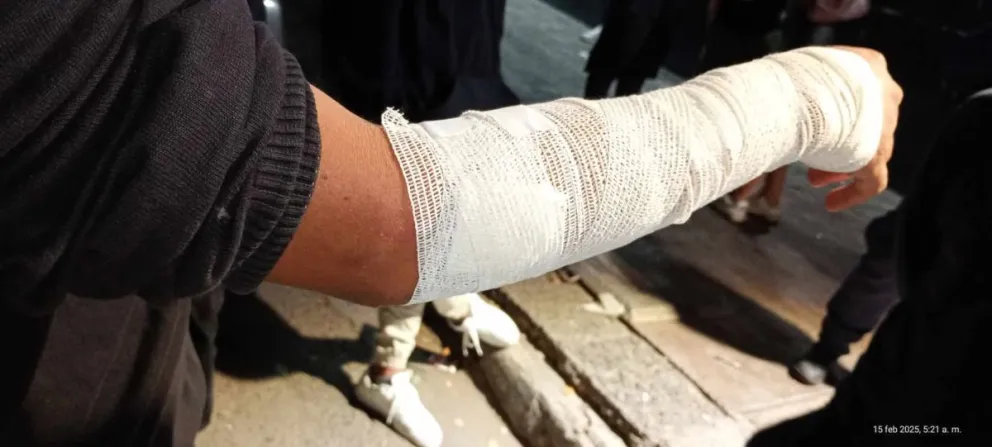 Grave episodio que podría haber terminado de peor manera. 