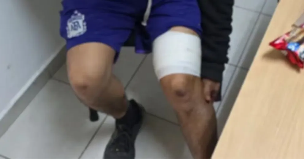 Fue por un tatuaje y salió herido.