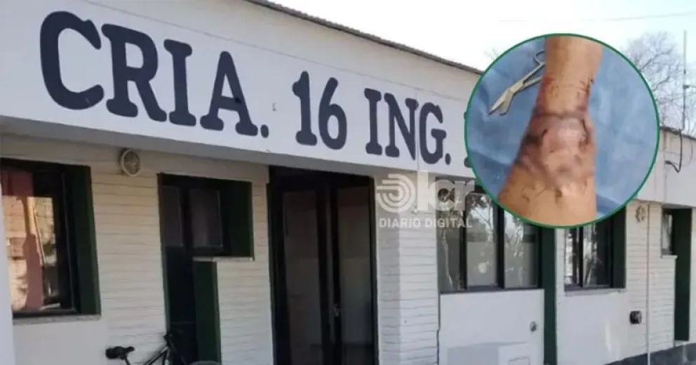 El ataque ocurrió el viernes y la denuncia se radicó ayer en la Comisaría 16. Foto gentileza.