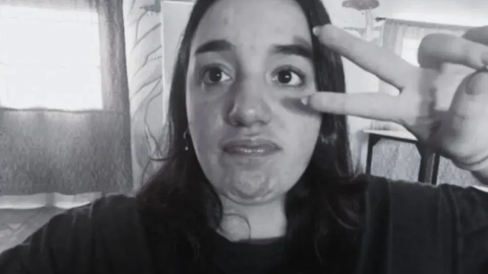 La joven de tan solo 17 años había logrado escapar del auto envuelto en llamas. (Foto gentileza)